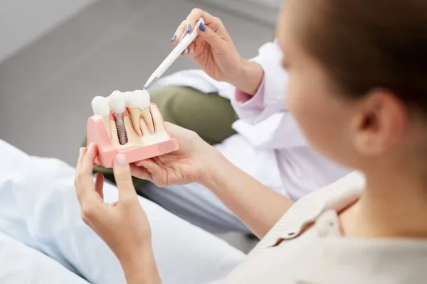 Dental Implants in Bellingham, WA